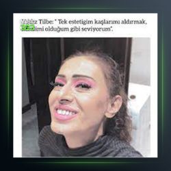 آهنگ Yüreğim Titriyor Korkuyla از ییلدیز تیبله